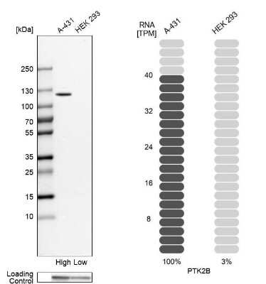 Western Blot: PYK2/FAK2 Antibody [NBP1-91228]