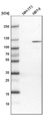 Western Blot: PYK2/FAK2 Antibody [NBP1-91228]