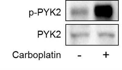 Western Blot: PYK2/FAK2 Antibody [NBP1-91228]
