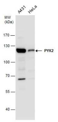 Western Blot: PYK2/FAK2 Antibody [NBP3-12969]