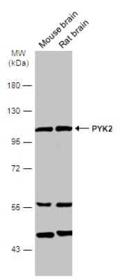 Western Blot: PYK2/FAK2 Antibody [NBP3-12969]