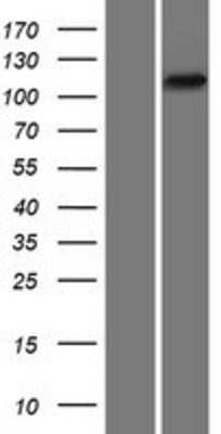 Western Blot: PYK2/FAK2 Overexpression Lysate [NBP2-05141]