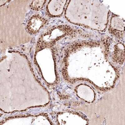 Immunohistochemistry-Paraffin: PYROXD1 Antibody [NBP2-38404]