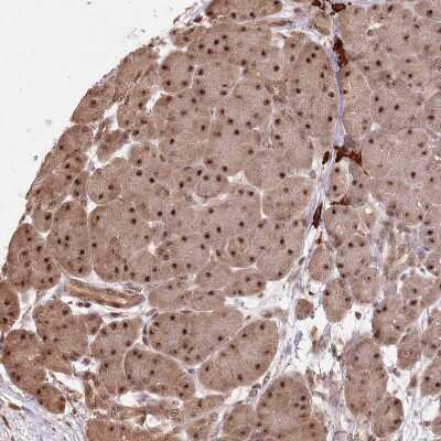 Immunohistochemistry-Paraffin: PYROXD1 Antibody [NBP2-38404]
