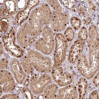 Immunohistochemistry-Paraffin: PYROXD1 Antibody [NBP2-38404]