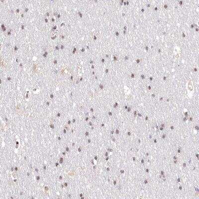 Immunohistochemistry-Paraffin: PYROXD1 Antibody [NBP2-38404]