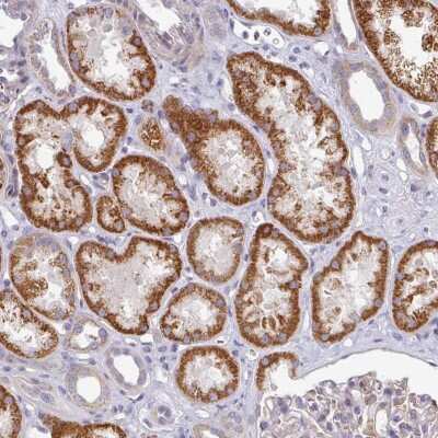 Immunohistochemistry: PYROXD2 Antibody [NBP2-32688]