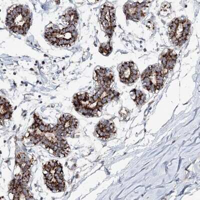 Immunohistochemistry-Paraffin: PYROXD2 Antibody [NBP1-88531]