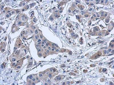 Immunohistochemistry-Paraffin: PYROXD2 Antibody [NBP2-20023]