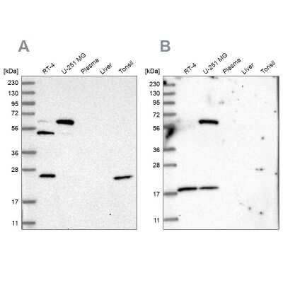 Western Blot: PYROXD2 Antibody [NBP1-88531]