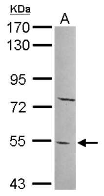 Western Blot: PYROXD2 Antibody [NBP2-20022]