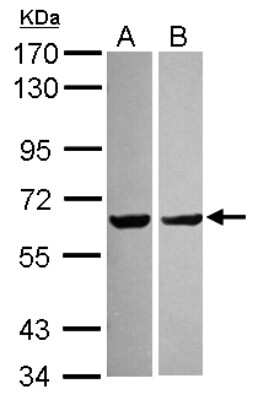 Western Blot: PYROXD2 Antibody [NBP2-20023]