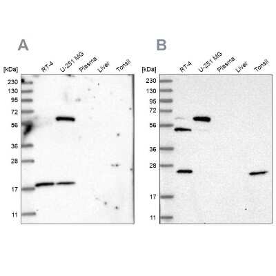 Western Blot: PYROXD2 Antibody [NBP2-32688]