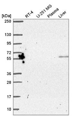 Western Blot: PYROXD2 Antibody [NBP2-57244]