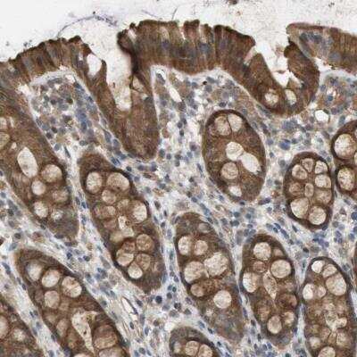 Immunohistochemistry-Paraffin: Paladin Antibody [NBP1-80952]