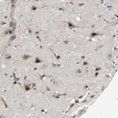 Immunohistochemistry-Paraffin: Paladin Antibody [NBP1-80953]
