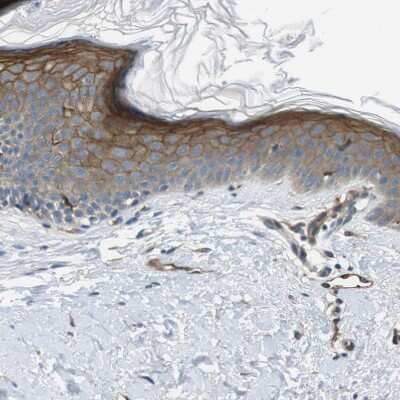 Immunohistochemistry-Paraffin: Paladin Antibody [NBP1-80953]