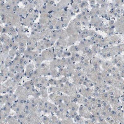 Immunohistochemistry-Paraffin: Paladin Antibody [NBP1-80953]