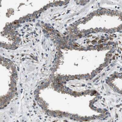 Immunohistochemistry-Paraffin: Paladin Antibody [NBP1-80953]