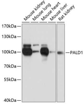 Western Blot: Paladin AntibodyAzide and BSA Free [NBP2-93550]