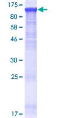 SDS-PAGE: Recombinant Human Paladin GST (N-Term) Protein [H00027143-P01]