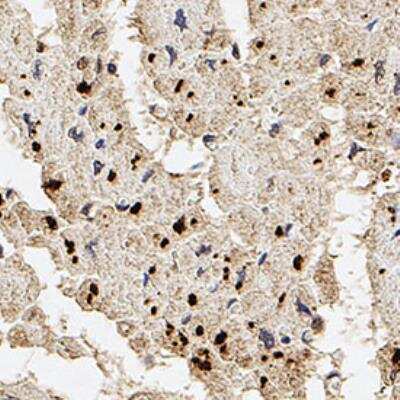Immunohistochemistry-Paraffin: Palladin Antibody (1E6) [NBP1-25959]