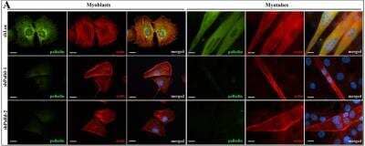 Knockdown Validated: Palladin Antibody (1E6) [NBP1-25959]