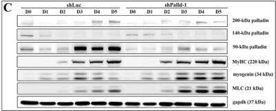 Knockdown Validated: Palladin Antibody (1E6) [NBP1-25959]