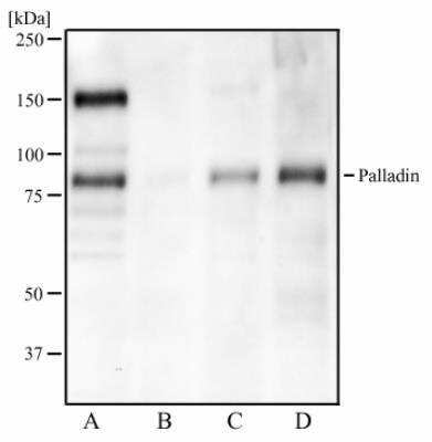 Western Blot: Palladin Antibody (1E6) [NBP1-25959]