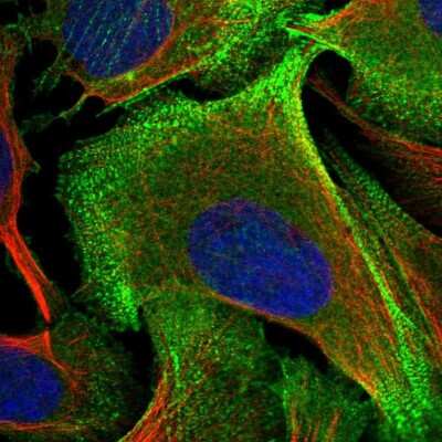 Immunocytochemistry/ Immunofluorescence: Palladin Antibody [NBP2-58731]