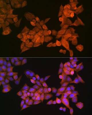 Immunocytochemistry/ Immunofluorescence: Palladin Antibody - Azide and BSA Free [NBP2-93983]