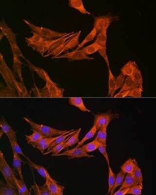 Immunocytochemistry/ Immunofluorescence: Palladin Antibody - Azide and BSA Free [NBP2-93983]