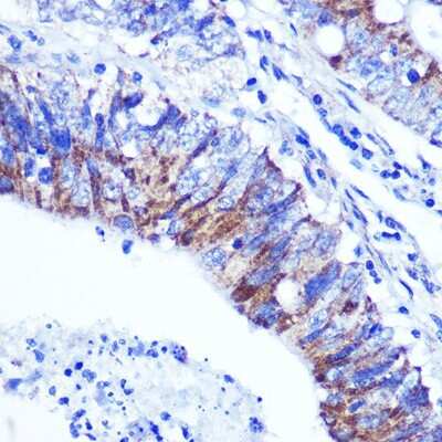Immunohistochemistry-Paraffin: Palladin Antibody - Azide and BSA Free [NBP2-93983]