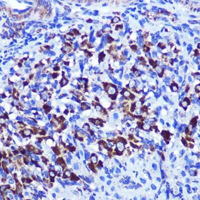 Immunohistochemistry-Paraffin: Palladin Antibody - Azide and BSA Free [NBP2-93983]