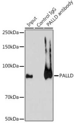 Immunoprecipitation: Palladin Antibody - Azide and BSA Free [NBP2-93983]