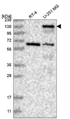 Western Blot: Palladin Antibody [NBP2-58731]