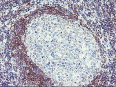Immunohistochemistry-Paraffin: Pallidin Antibody (OTI1H9) [NBP2-01763]