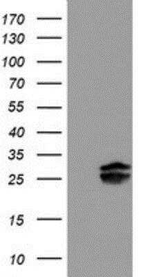 Western Blot: Pallidin Antibody (OTI1H9) [NBP2-01763]