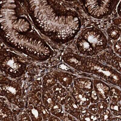 Immunohistochemistry-Paraffin: Pallidin Antibody [NBP1-87357]