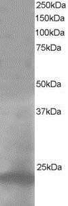 Western Blot: Pallidin Antibody [NB100-1234]