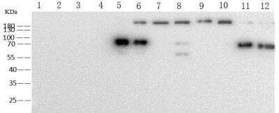 Western Blot: Pan Coronavirus Spike Antibody (38) [NBP3-14660]