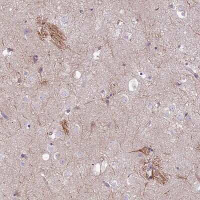 Immunohistochemistry-Paraffin: Pan KvBeta Antibody [NBP1-90194]