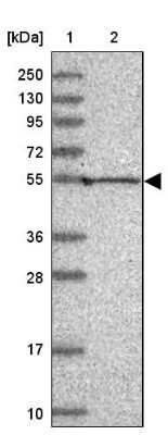 Western Blot: Pan KvBeta Antibody [NBP1-90194]