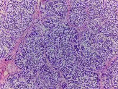 Hematoxylin & Eosin Stain: Pancreas Tissue Slides (Adult Normal)- Frozen [NBP2-77581]