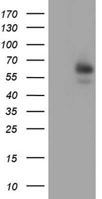 Western Blot: Pancreatic Amylase Alpha Antibody (OTI1E3) [NBP2-46518]