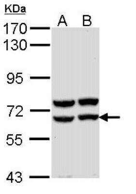 Western Blot: Pancreatic Amylase Alpha Antibody [NBP1-31724]