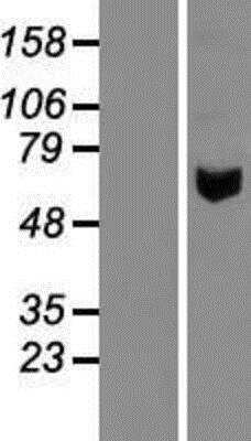 Western Blot: Pancreatic Amylase Alpha Overexpression Lysate [NBL1-07509]