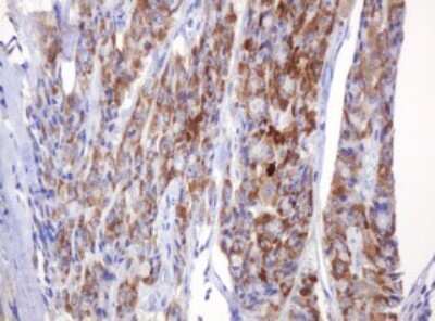 Immunohistochemistry: Pancreatic Amylase Beta Antibody (OTI4B5) [NBP2-45492]