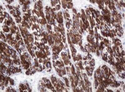 Immunohistochemistry: Pancreatic Amylase Beta Antibody (OTI4B5) [NBP2-45492]