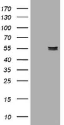 Western Blot: Pancreatic Amylase Beta Antibody (OTI4B5) [NBP2-45492]